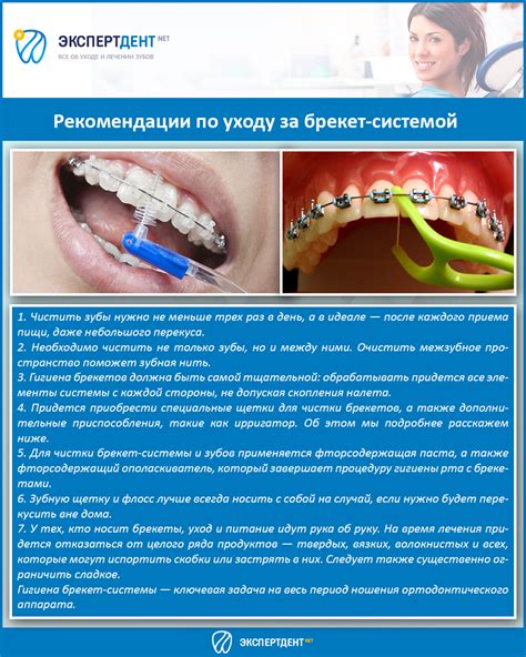 Нечаянная потеря брекетов: на что это действительно указывает?