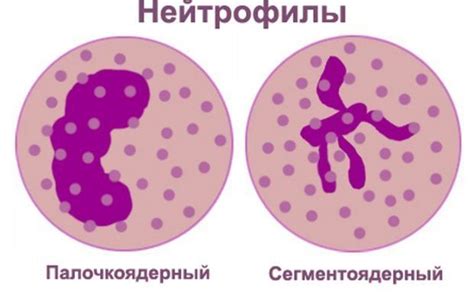 Низкий уровень нейтрофилов в крови