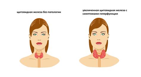 Низкий уровень тиреоидных гормонов