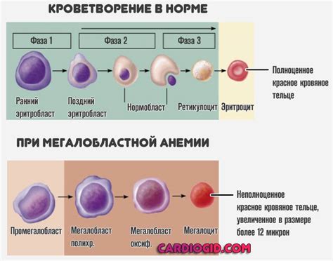 Низкофлуоресцирующие ретикулоциты понижены