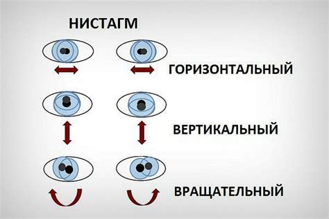 Нистагм глаз: понятие и особенности