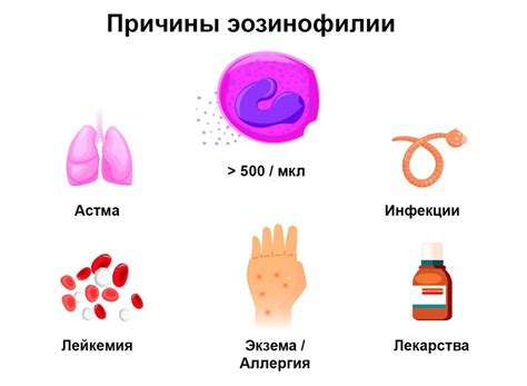 Нормальный уровень эозинофилов в организме