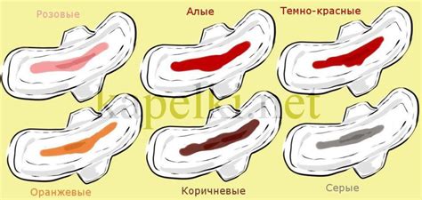 Нормальный цвет выделений во время месячных