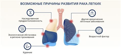 Обзор причин и значений боли в легких