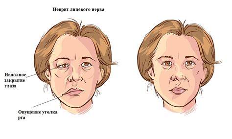 Облизывание лица - проявление защитительного инстинкта