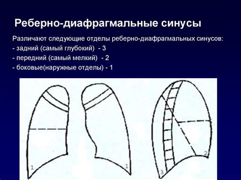 Облитерация левого реберно-диафрагмального синуса