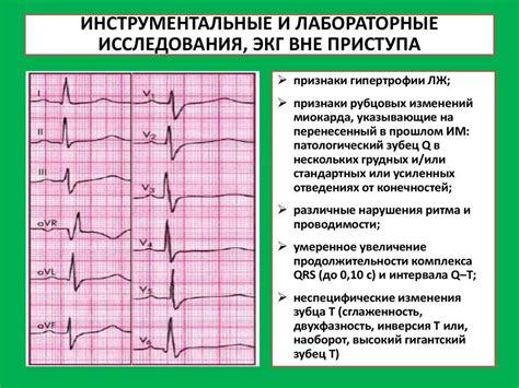 Обменные изменения миокарда