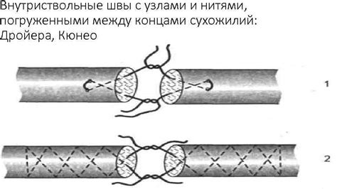 Общие принципы и рекомендации по правильному способу нанесения швов во время сна