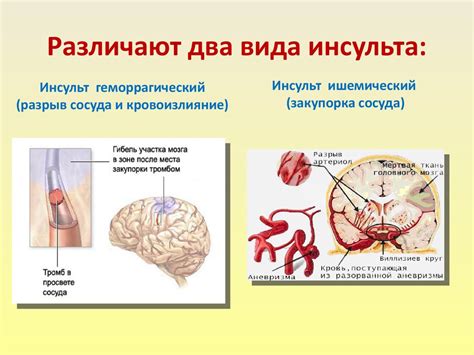 Оглушенное сознание при инсульте: в чем причины?