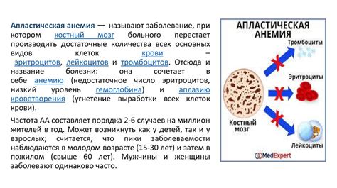 Ограничение жизнедеятельности 2 степени