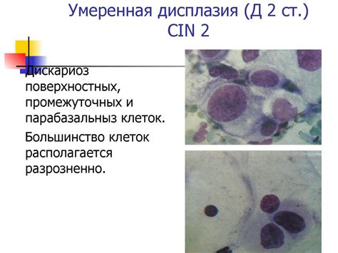 Ограничения цитологического исследования по TBS