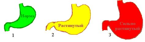 Ожирение и растянутый желудок