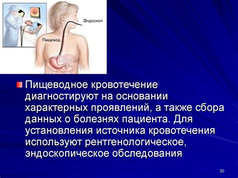 Ожог и тошнота при заболеваниях желудочно-кишечного тракта