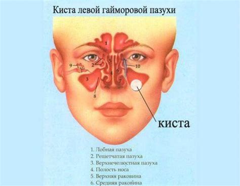 Околоносовые пазухи: что это значит