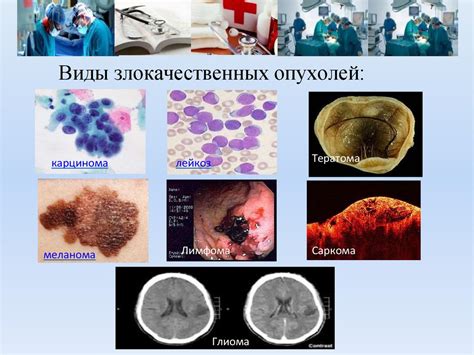 Онкологические заболевания: связь с выделением жидкости из груди