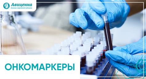 Онкомаркеры в медицине