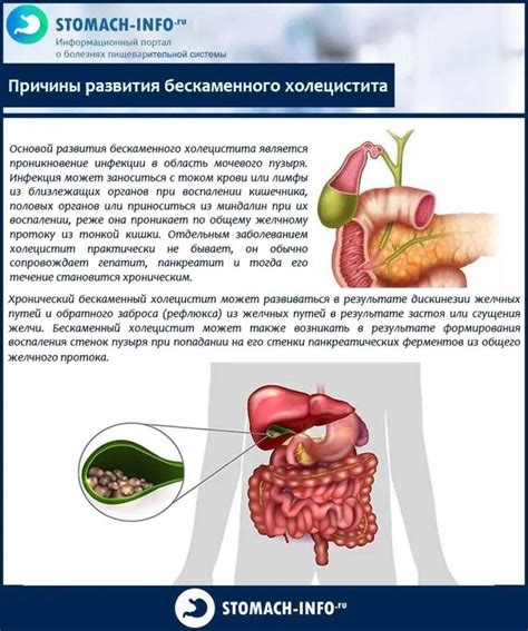 Оперативное лечение бескаменного холецистита