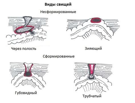 Операционный шов