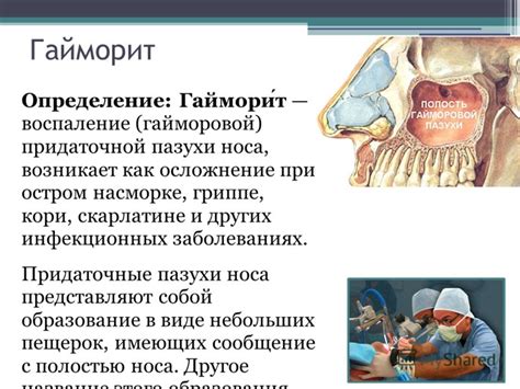 Определение заострения носа