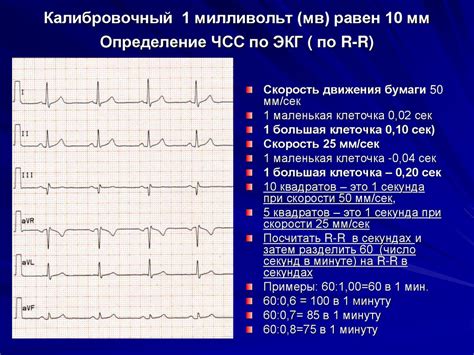 Определение и значение ЭКГ