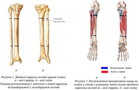 Определение и особенности голени  гп