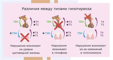 Определение и симптомы первичного гипотиреоза