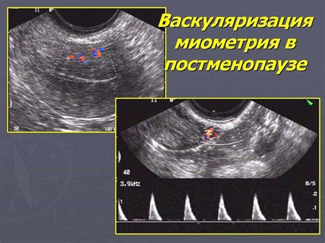 Определение и сущность Нгэ в гинекологии