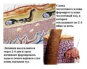 Определение и характеристика водянистых волдырей