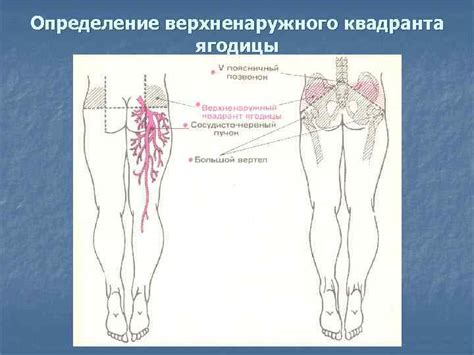 Определение контралатеральной ягодицы