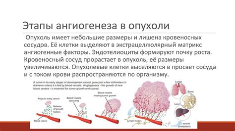 Определение морфологического типа опухоли и его классификация