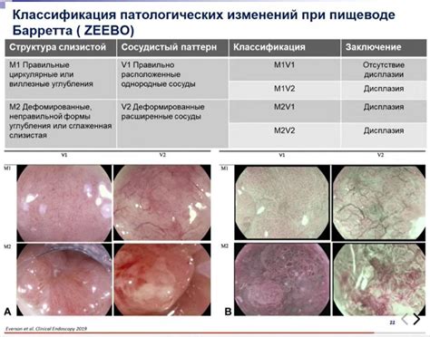 Определение патологических изменений