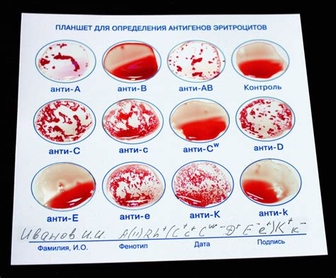 Определение понятия "разрешение крови по совести"