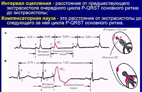 Определение процессов возбуждения