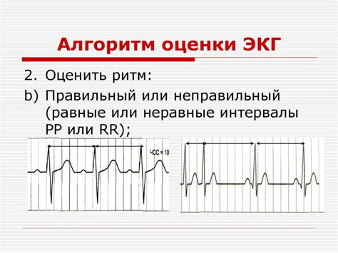 Определение пушечного ритма