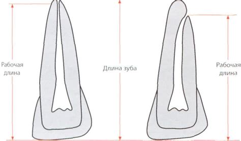 Определение рабочей длины и ее значение