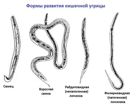 Определение угрица кишечной