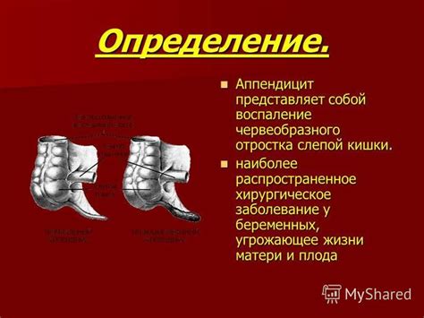 Определение укорененного отростка