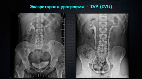 Определение урографии