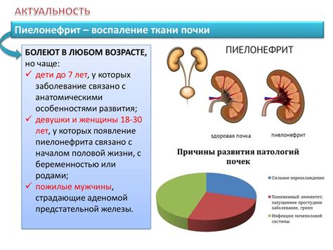 Определение хронического пиелонефрита