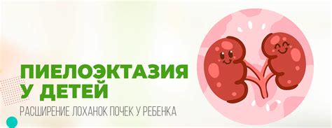 Опускание почек у ребенка