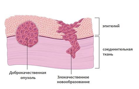 Опухоль и новообразования