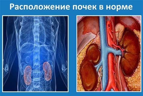 Опущение почки второй степени: причины