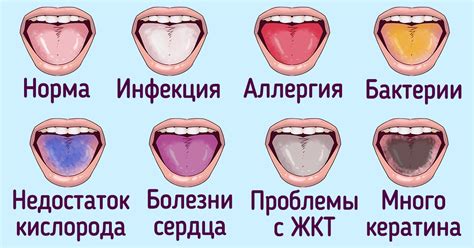 Оранжевый цвет языка: говорит о проблемах с пищеварением