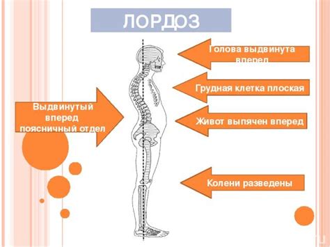 Осанка: понятие и его значение