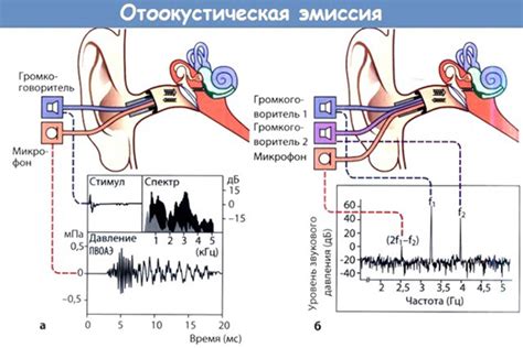 Ослабление отоакустической эмиссии: возможные причины