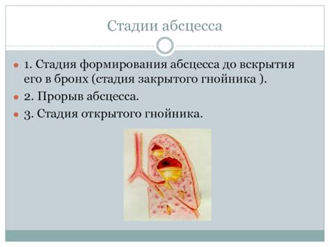 Осложнения абсцесса до вскрытия