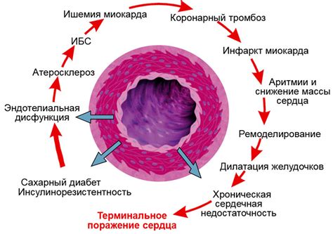 Осложнения гипергликемии у женщин