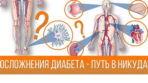 Осложнения и последствия необнаруженного сахарного диабета