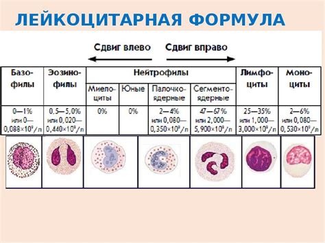 Осложнения лейкоцитоза сдвига влево