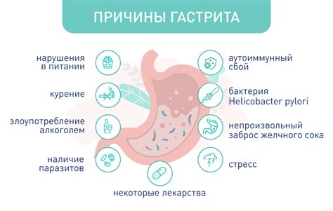 Осложнения мигрирующей грыжи: что может произойти?